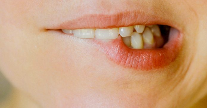 Bitten lip How long do cold sores last?